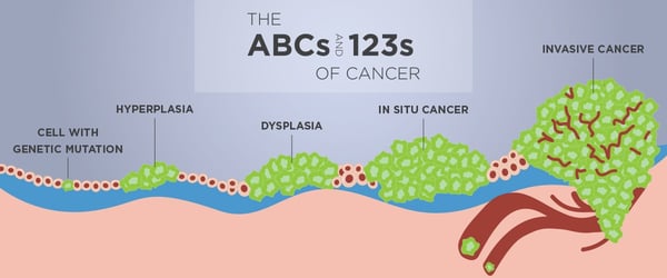 2019-cancer-stages-blog-graphics-header-2
