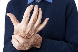 arthritis hands