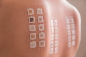 patch allergy testing