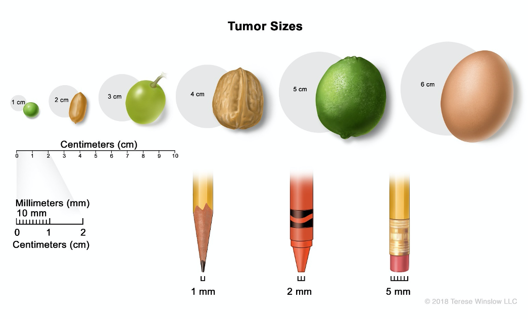 tumor sizes