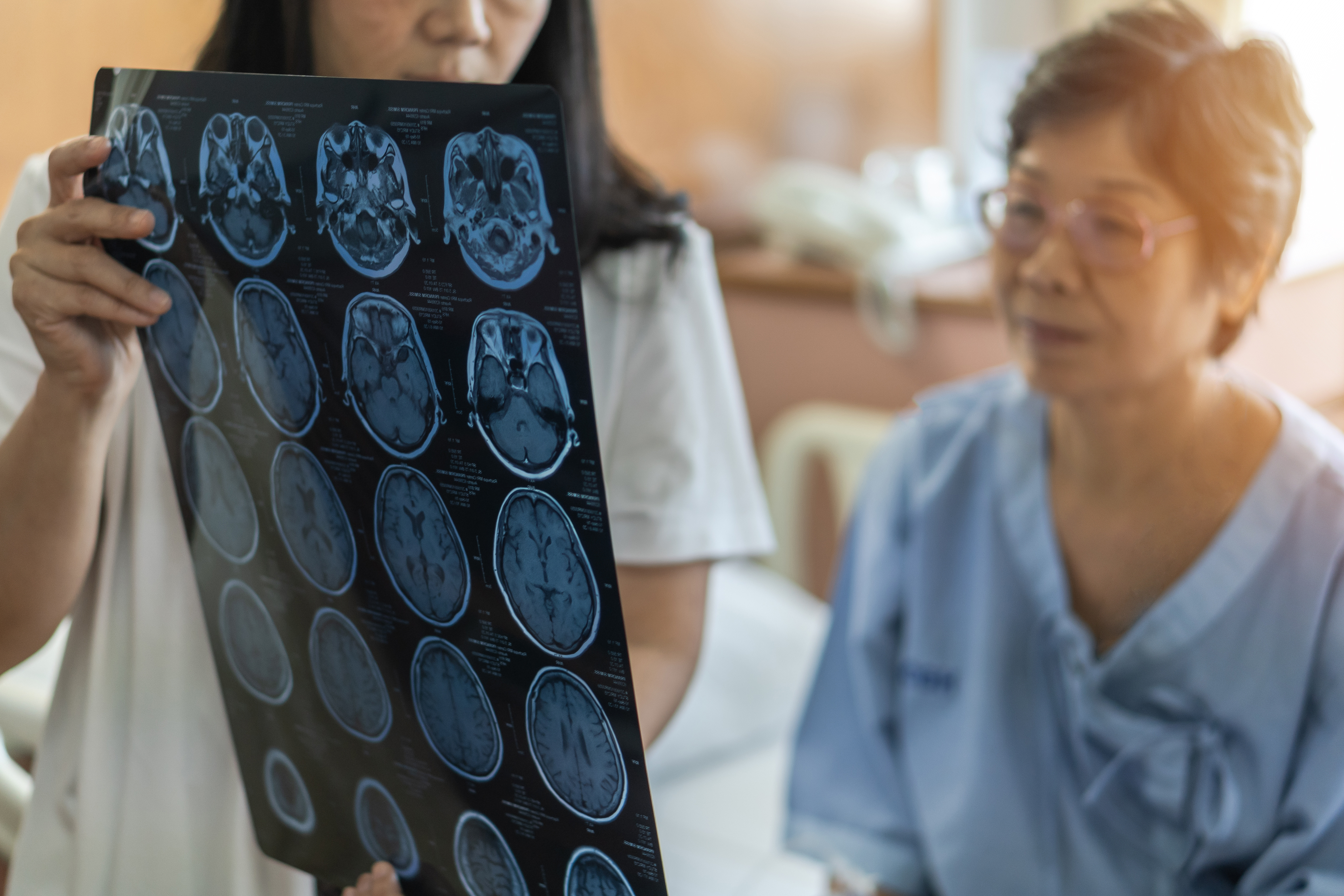 Stroke Rehabilitation: Home Health Services Following a Stroke