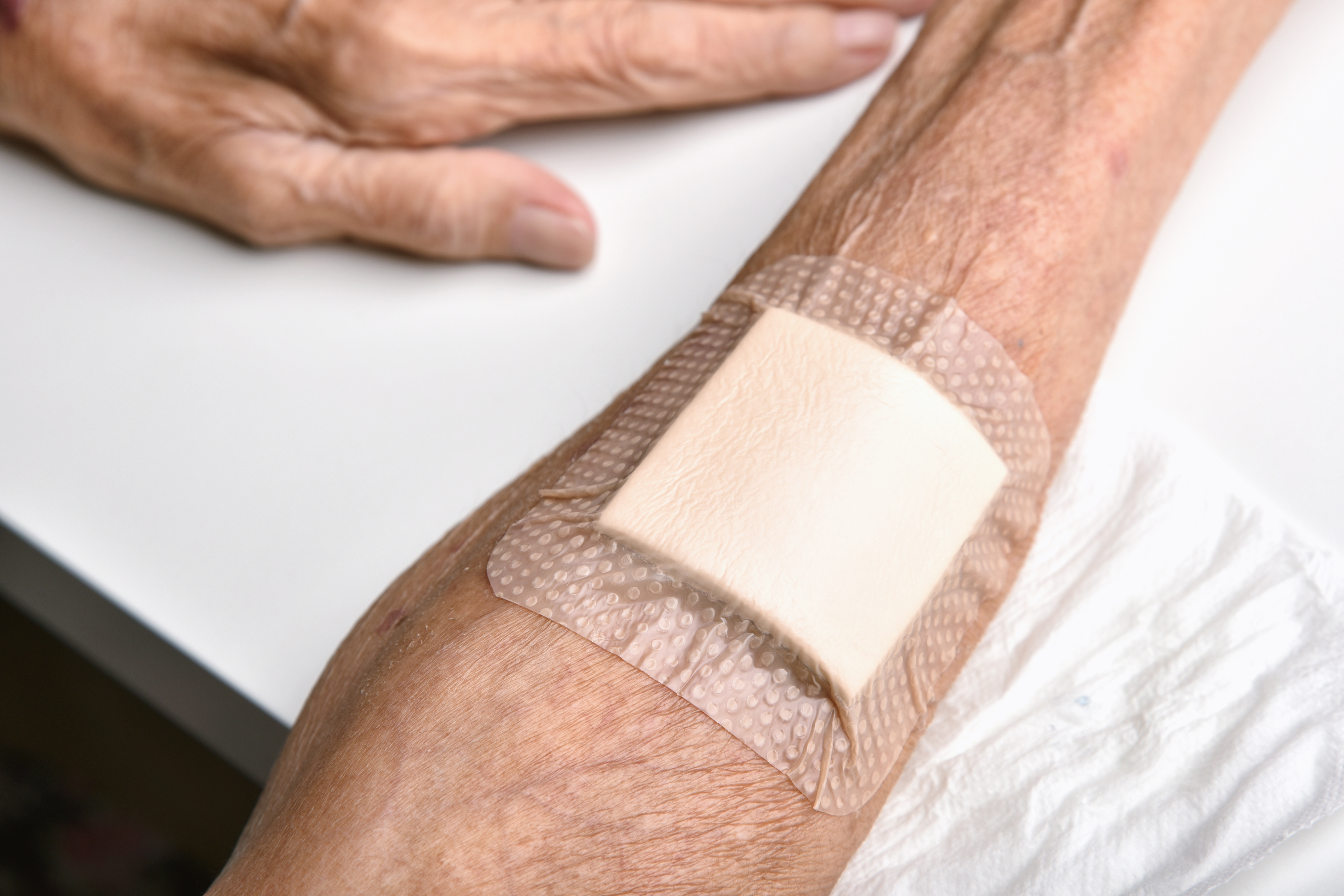 Nurturing Healing: The Remarkable Benefits of Diabetes Wound Care
