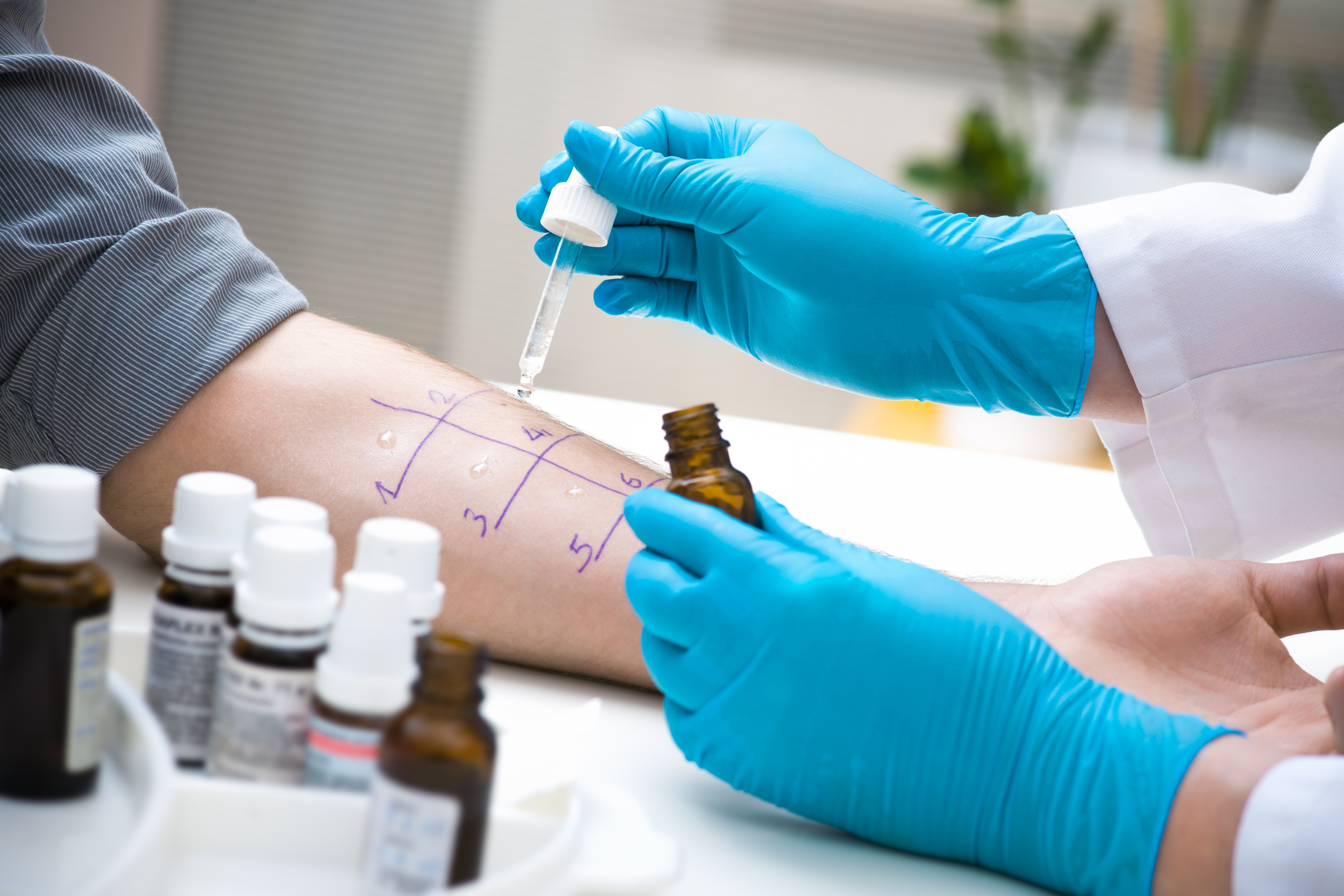 When Is It Time to See a Doctor About Your Allergies?