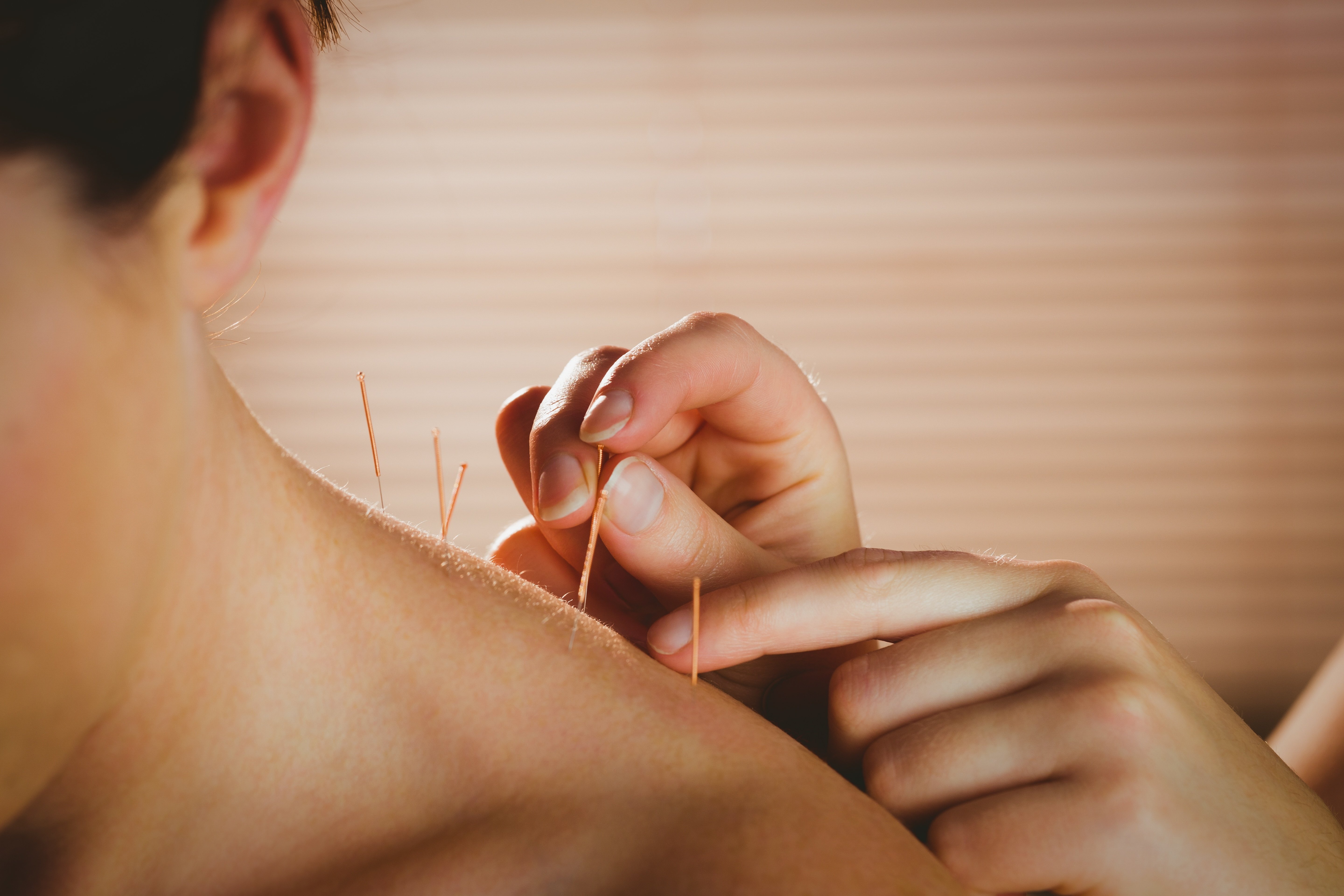 Baton Rouge Area Acupuncture Services: The Benefits of Acupuncture Treatment