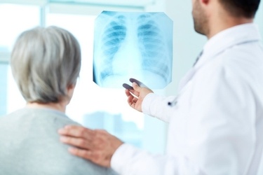 Lung Cancer Screenings Baton Rouge | CT Lung Cancer Screenings