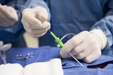 What is Transradial Cardiac Catheterization?