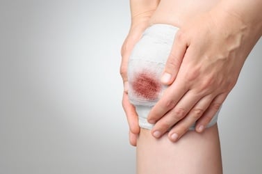4 Signs a Wound Requires Additional Care