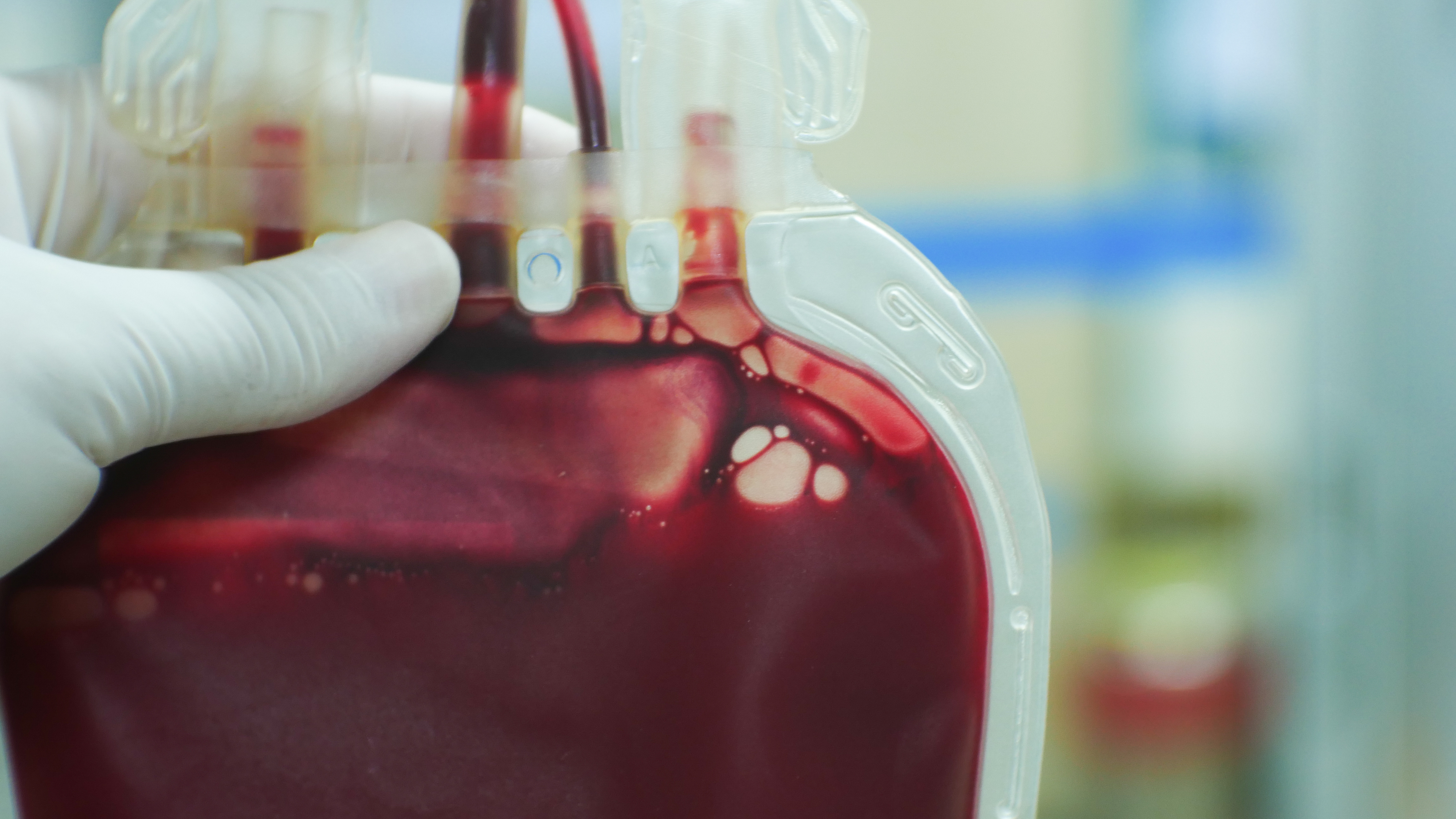 Blood Type and Blood Donation During Coronavirus