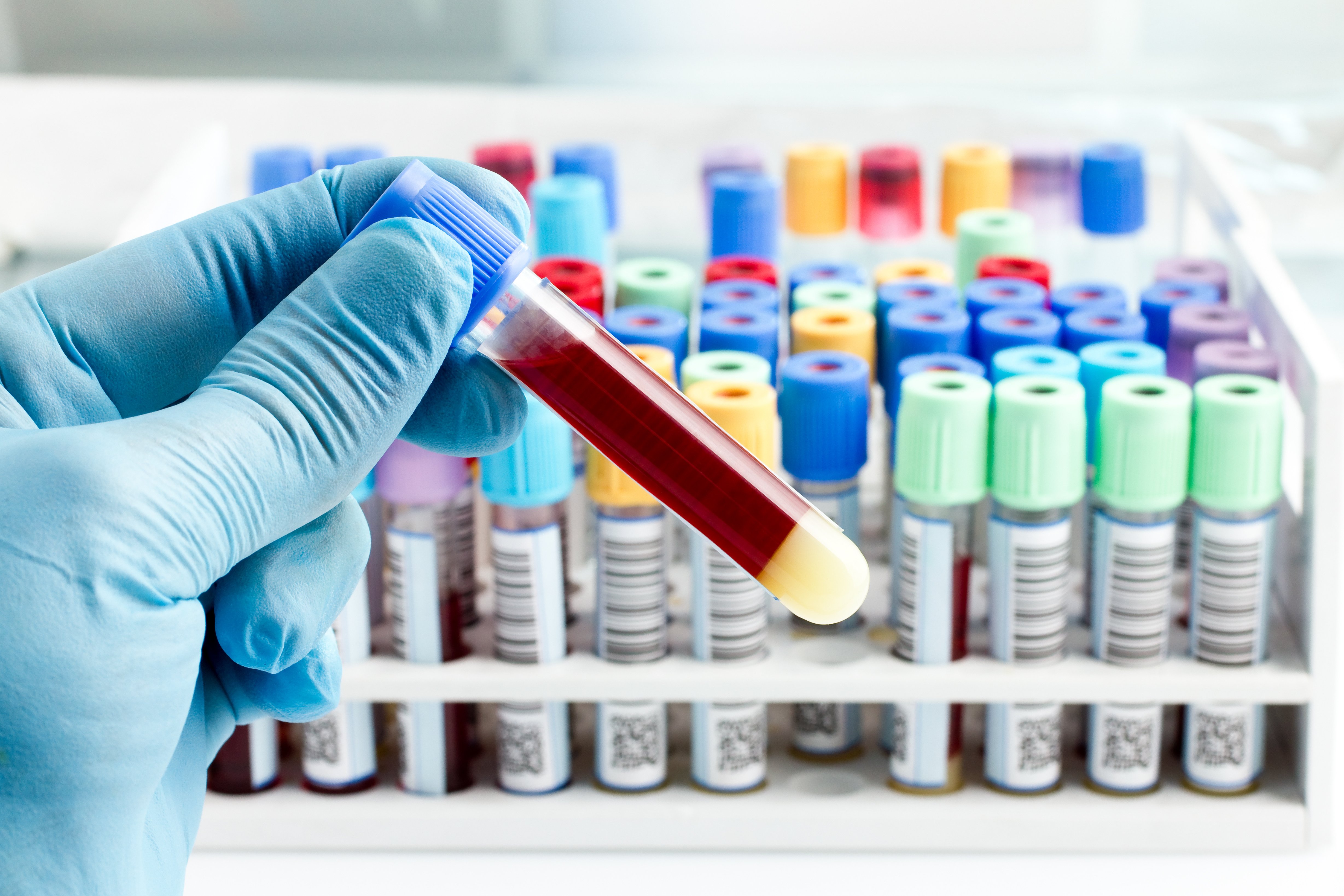 Laboratory Testing at Lane Regional Medical Center: Types of Blood Work