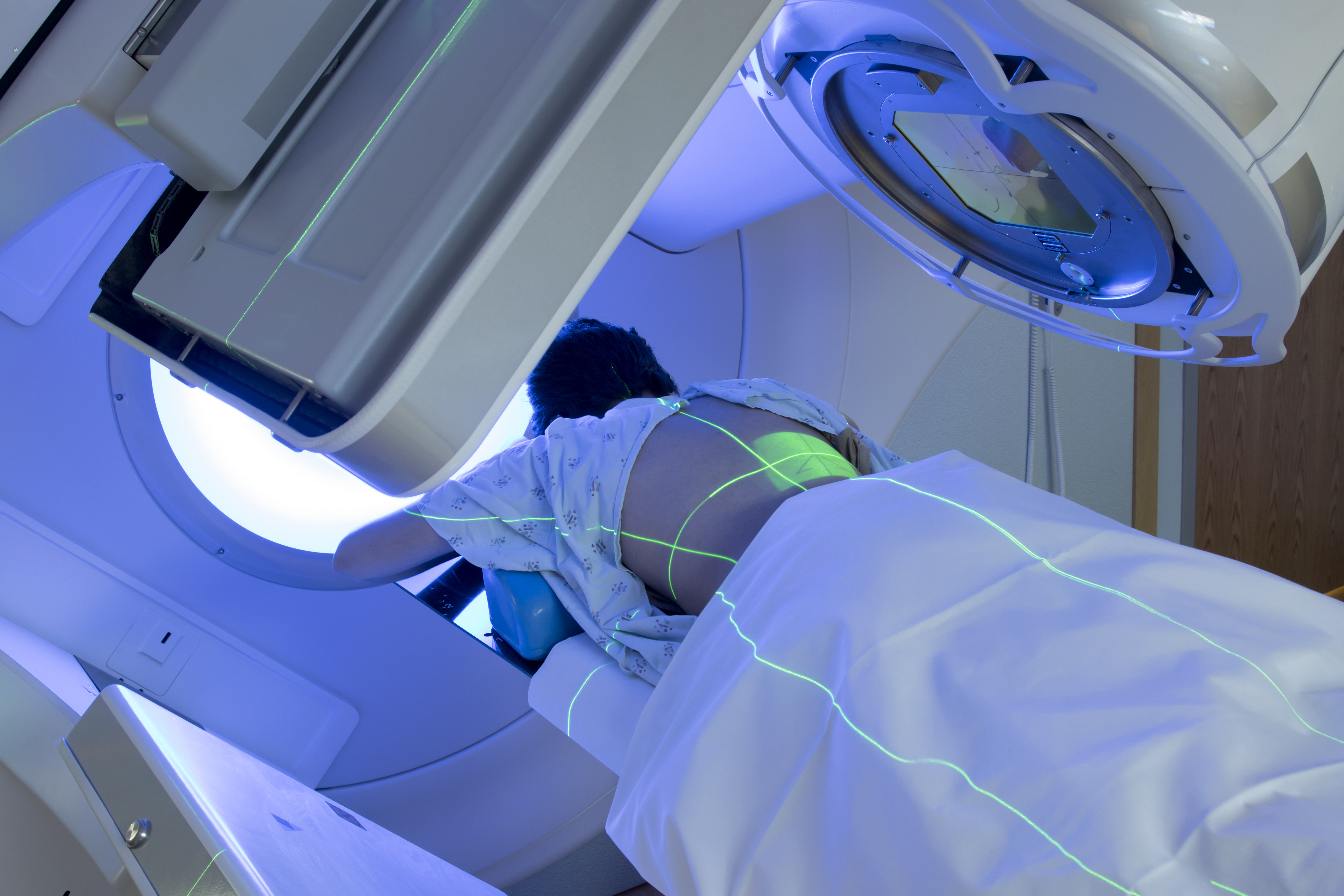 Radiation Dermatitis and Hyperbaric Oxygen Therapy